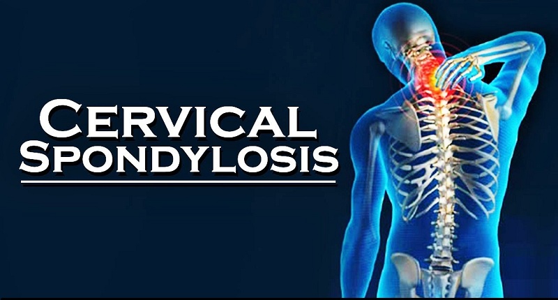 Cervical spondylitis treatment in delhi